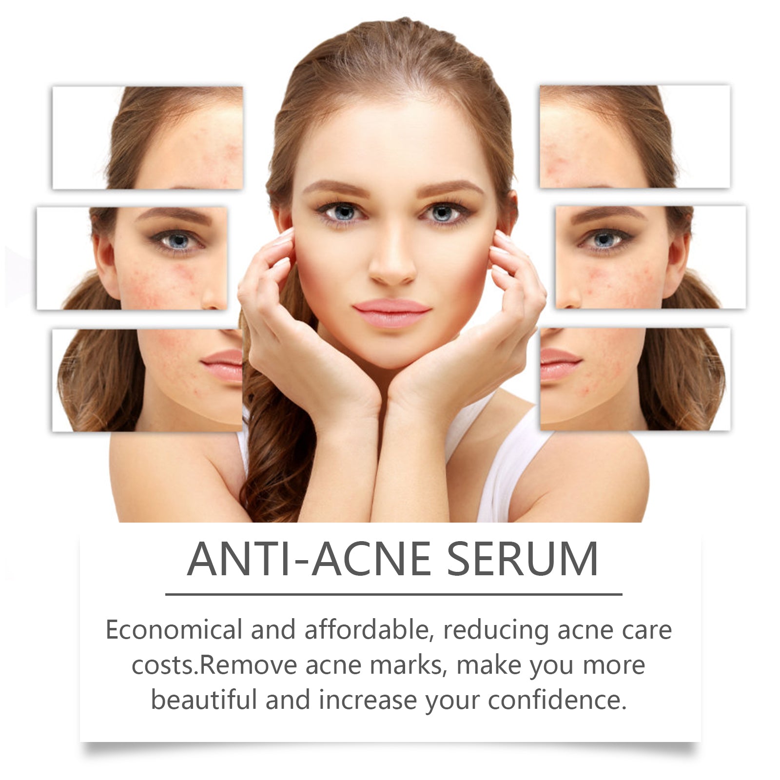 Hoygi Nicotinamide Anti-Acne Serum Mild Anti-Acne Serum Improve Acne Moisturizing Repair Serum 5 0626722f-cb81-4e96-941b-879f8047c4d3 null