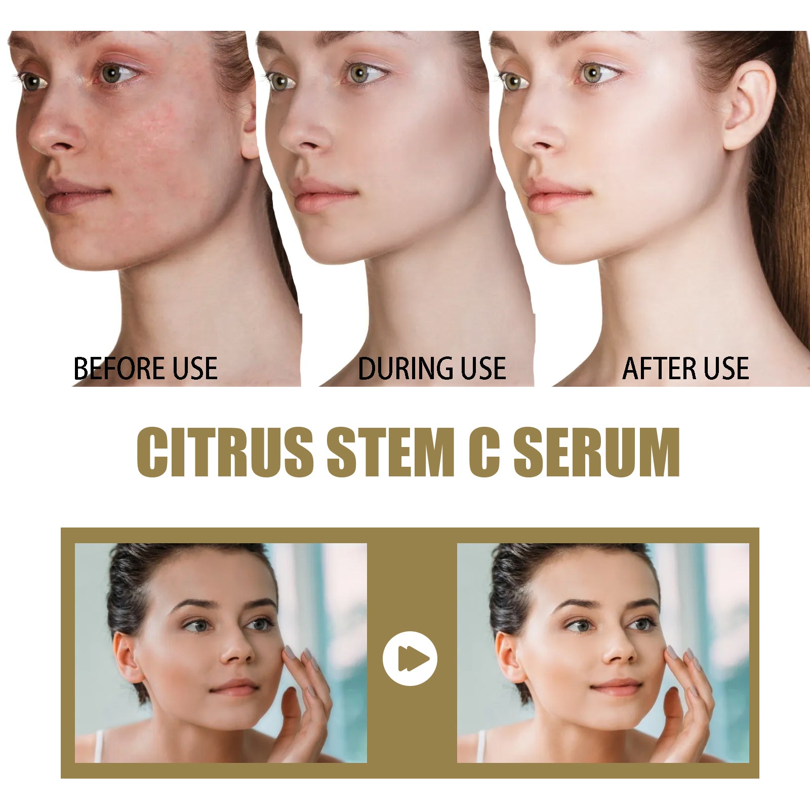 Hoygi Citrus Stem C Serum, Reduce Wrinkles Improve Skin Elasticity Firming And Lifting Anti-Aging Serum 5 649ac5dd-1129-465f-9a1a-8683be44b1a2 null
