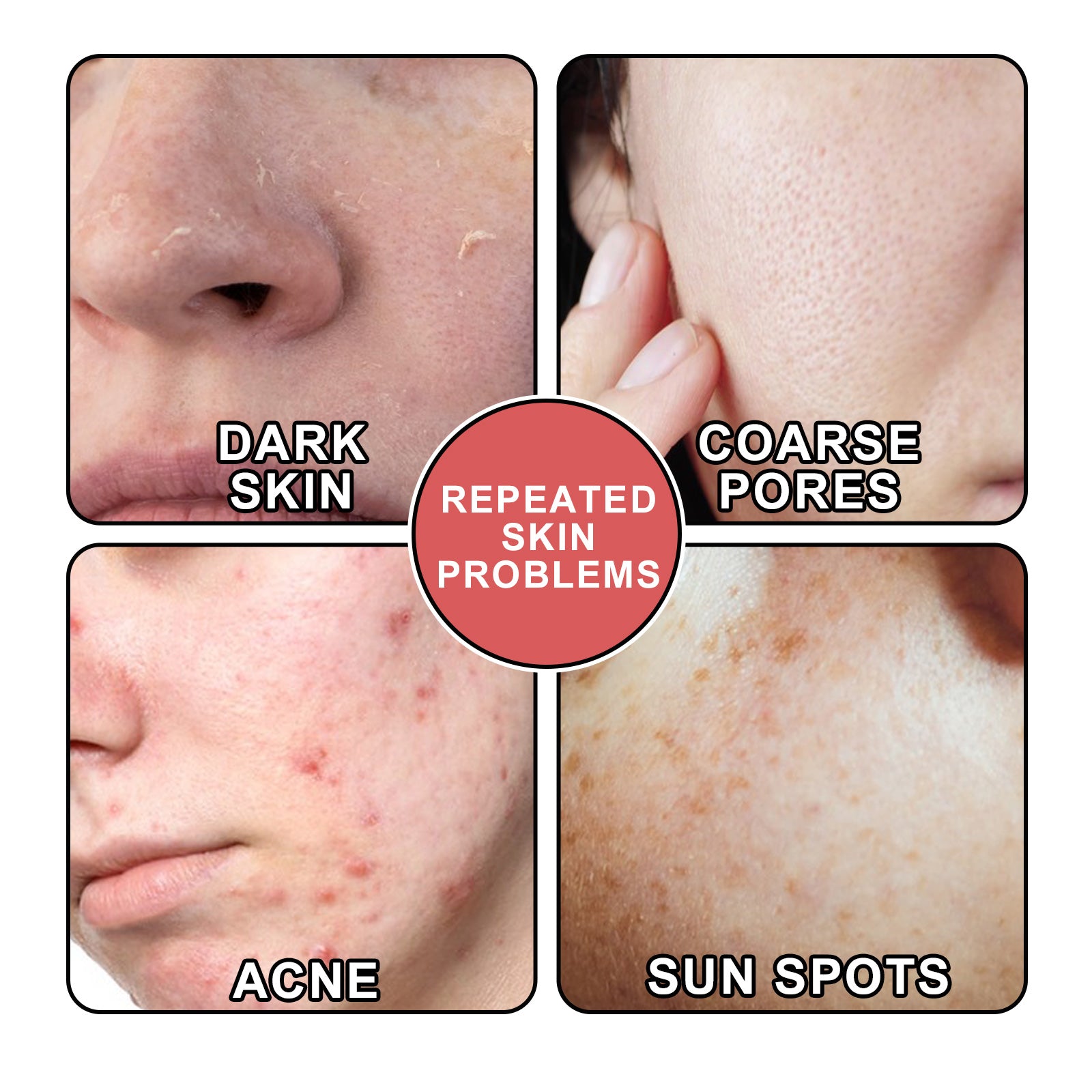 South Moon Nicotinamide Skin Care Essence Facial Skin Hydrating And Firming Skin Care Essence 5 81c98776-6a1d-467e-a2cc-cc177e8b73f9 null