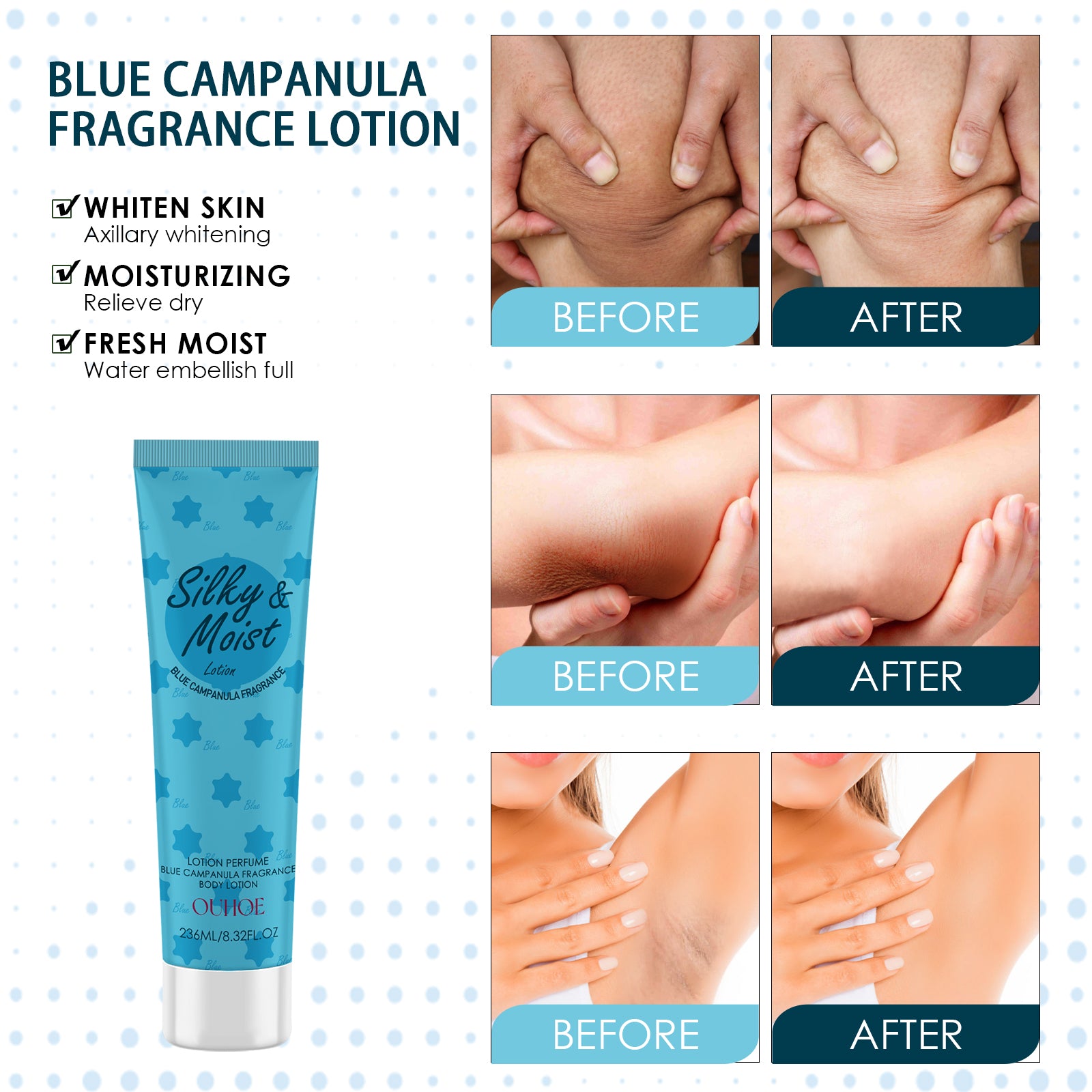 OUHOE Body Toner Lightening Armpit Knee Joint Dark Moisturizing Skin Whitening Body Beauty Care 5 8cc86cdb-573c-42df-bfd9-86f26fe38bdf null