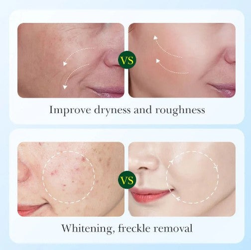 Sadoer - Licorice Root Whitening Skin Care Set 5 94e0ac49-0111-43b3-abac-867fee028996 null