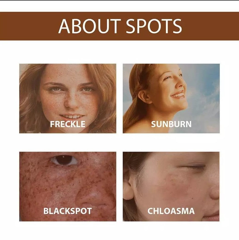 Anti Freckle Serum 5 ad70dee8-a0a3-4146-80bf-8857f3176ee0 null