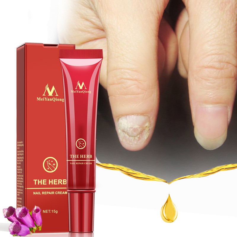 Beauty Hand And Foot Nail Repair Cream 0 ad7dc8d3-a9d3-4679-bee1-2f6723978773 null