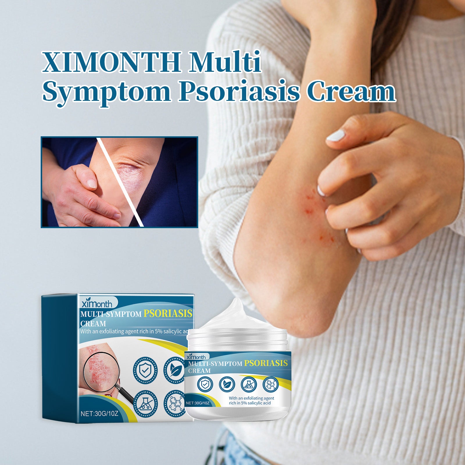 Ximonth Psoriasis Treatment Cream Repair Hand, Foot And Body Moss Redness And Itchy Skin Topical Treatment Cream 5 c51a1f4a-6f80-4713-8565-2184a4d4dca4 null