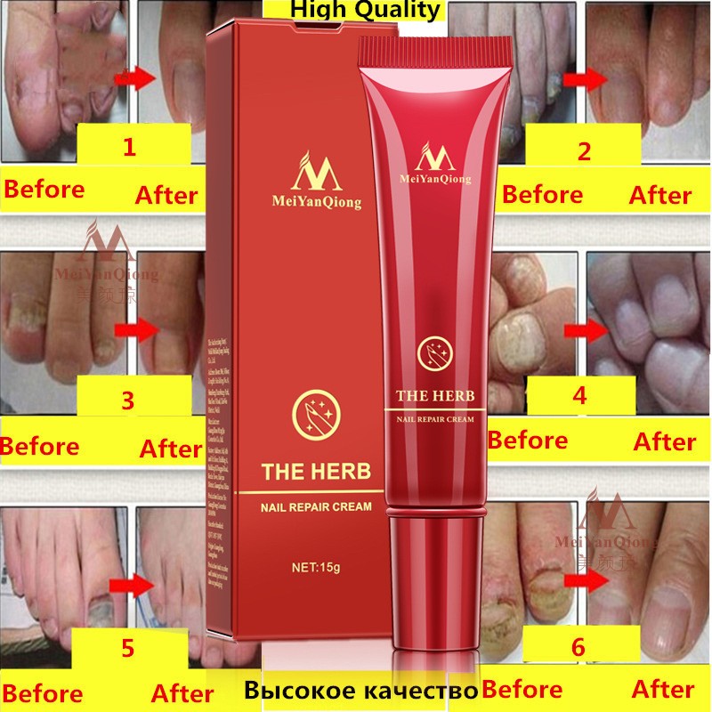 Beauty Hand And Foot Nail Repair Cream 0 cab34bf3-94cd-4a94-b05e-f6747011c850 null