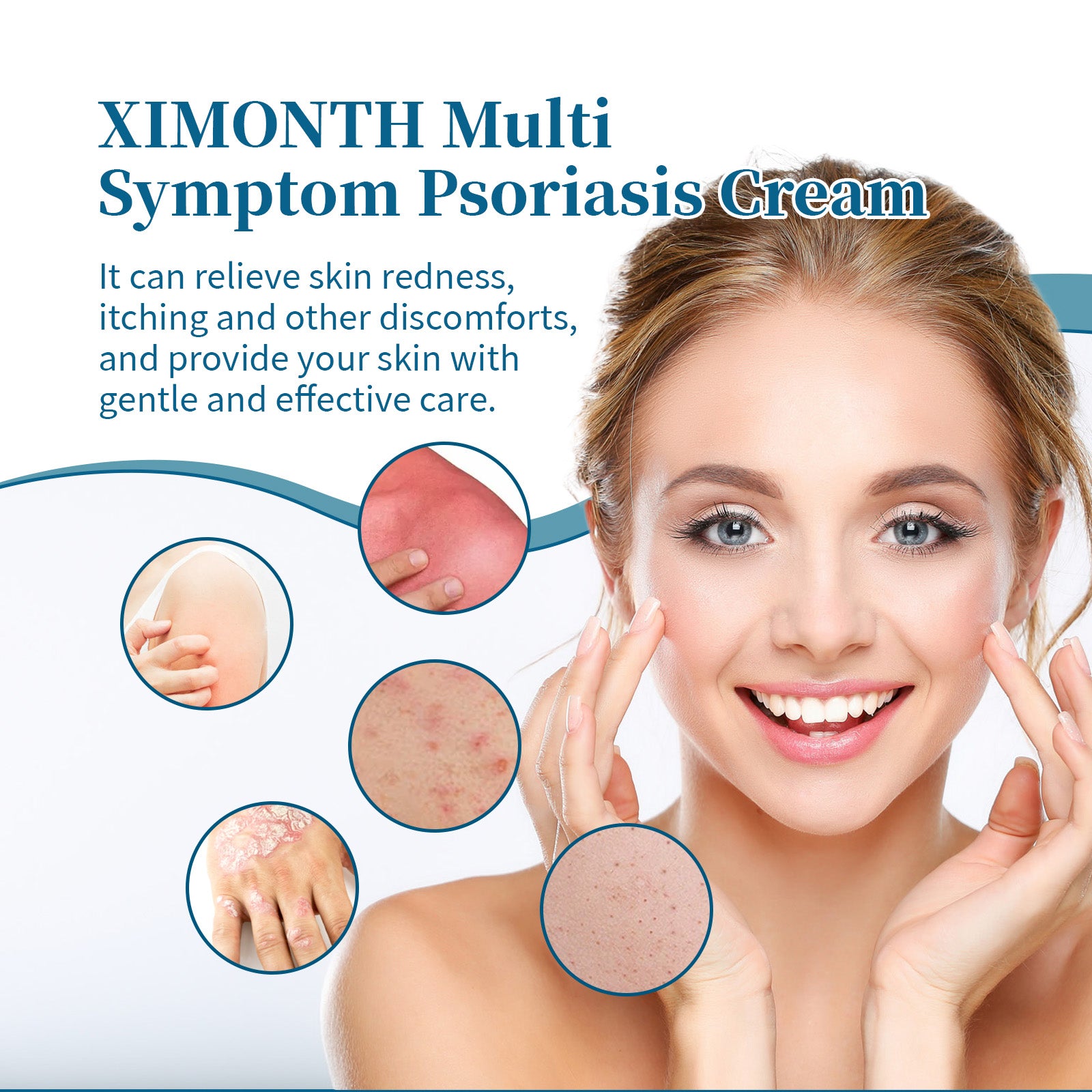 Ximonth Psoriasis Treatment Cream Repair Hand, Foot And Body Moss Redness And Itchy Skin Topical Treatment Cream 5 d5411cdc-10b4-43ca-9171-6c9f409940c5 null