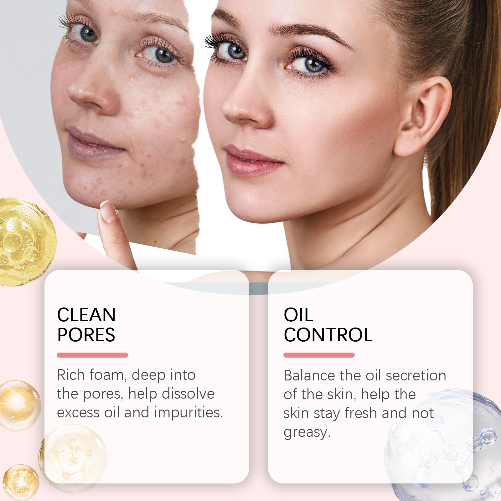 OUHOE Salicylic Acid Foam Cleanser Gentle Moisturizing Oil Control Facial Skin Cleansing Delicate Pore Cleanser 5 ebf21f4b-d501-4b20-863a-1bf9fc54b9cb null