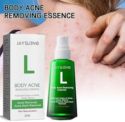 Body Pimple Repair Moisturizer 5 ef33d1be-ad9f-4713-aa16-c3bc4b0eacf8 null