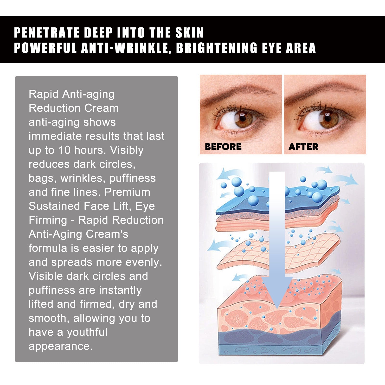 Hoygi Aloe Vera Eye Gel Patch Reduces Fine Lines Under Eyes, Dark Circles Under Eyes, Firming Eyes, Anti-Wrinkle And Moisturizing Eye Patch 5 fb08dd74-989f-454f-a298-f5e5d4dcca76 null